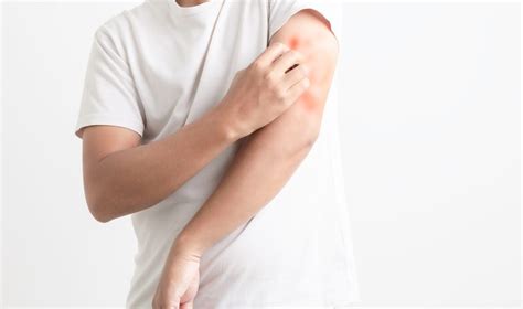 How To Maintain The Dry Itchy Eczema That S Covering Your Skin