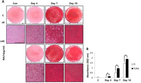 Effect Of Ra On Mineralization Through Alizarin Red S Staining In Download Scientific Diagram