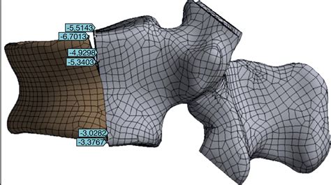 SciELO Brasil MECHANICAL BEHAVIOR OF THORACOLUMBAR CORONAL SPLIT