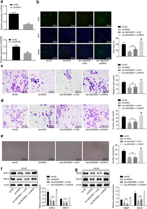 Linc00261 Promoted The Expression Of Dkk3 To Suppress The Metastasis Download Scientific