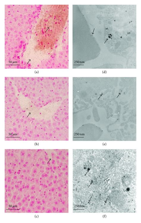 Microscopic Autoradiography A B C And TEM Images D E F From A