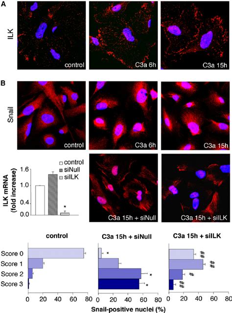 C A Induces Ilk Dependent Snail Activation In Human Cultured Podocytes