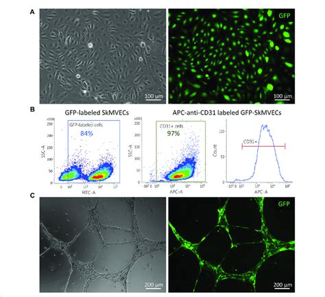 GFP Expressing SkMVECs A Microscopic Image Of Cobblestone Shaped