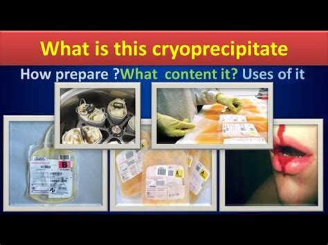 Cryoprecipitate Preparation