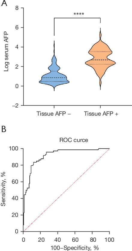 Figure 1 From Serum Alpha Fetoprotein As A Predictive Biomarker For