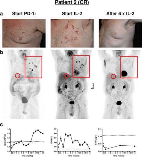 Clinical Course Of Patient A Representative Clinical Pictures Of