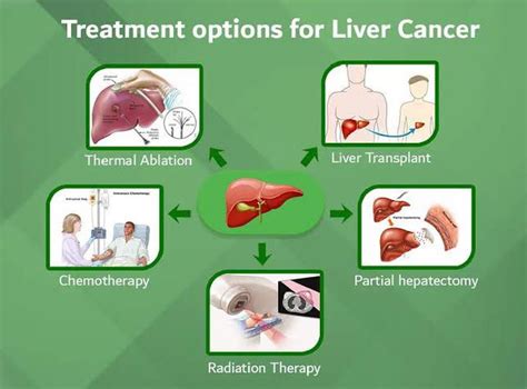 Treatment Options For Liver Cancer Medizzy