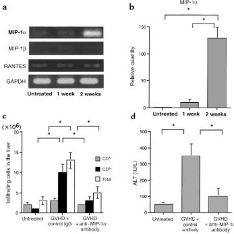 A Kinetics Of Ccr1 Ccr4 Cxcr3 And Ccr5 Mrna Expression In Liver