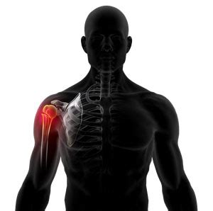 Shoulder Fracture Care Oklahoma County | Clavicle Fracture Care Oklahoma County