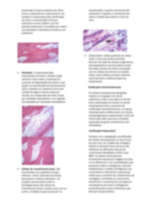 Solution Resumo De Histologia Tecido Sseo Studypool