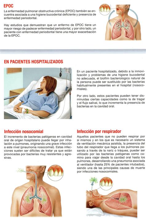 Patologia Respiratoria Clínica Dental Vistalegre Dentista