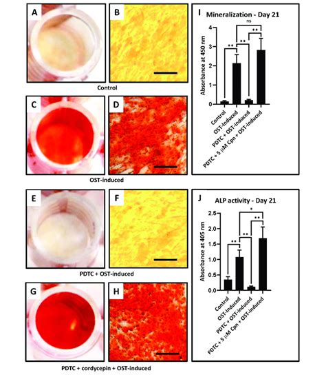 Osteogenic Differentiation Of Dpscs Quantification Of Mineralization Download Scientific