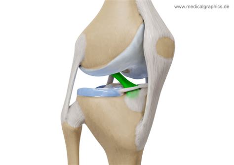 Anterior Cruciate Ligament Medicalgraphics