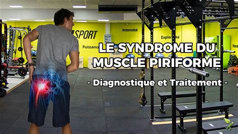 LE SYNDROME DU MUSCLE PIRIFORME Diagnostic Et Traitement YouTube