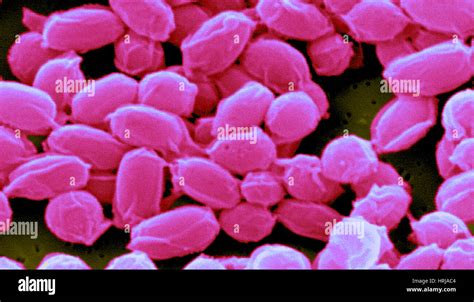 Anthrax Bacillus Anthracis Bacteria Sem Stock Photo Royalty Free