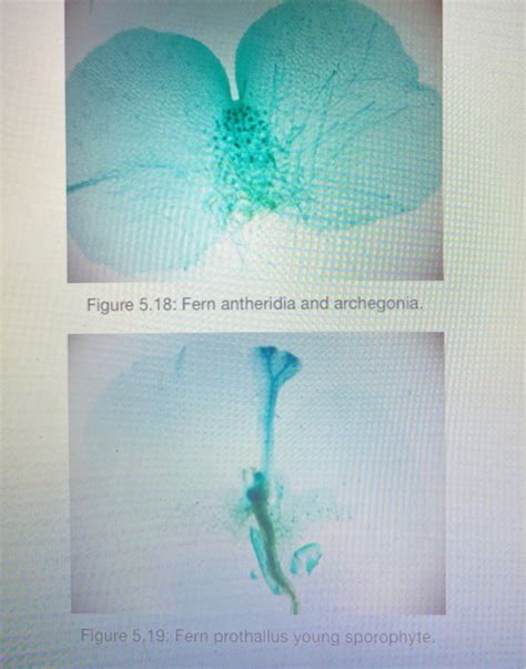 Solved ACTIVITY FERNS Fern sporophyte (Figure 5.17) Fern | Chegg.com