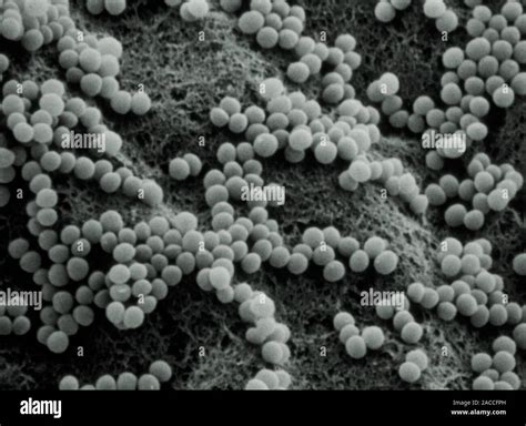 False Colour Transmission Electron Micrograph Tem Of An Individual