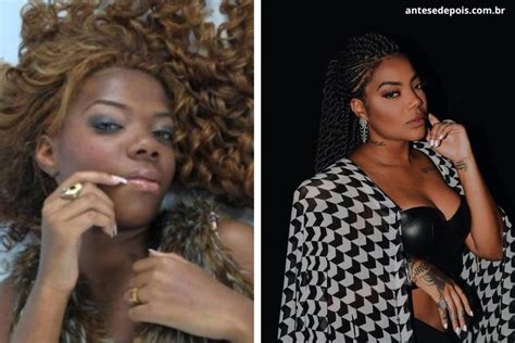 Ludmilla Antes E Depois Da Cantora Ap S Cirurgias Pl Stica Dos Famosos