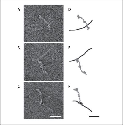 Electron Micrographic Visualisation Of Fxiii Mediated Cross Linking