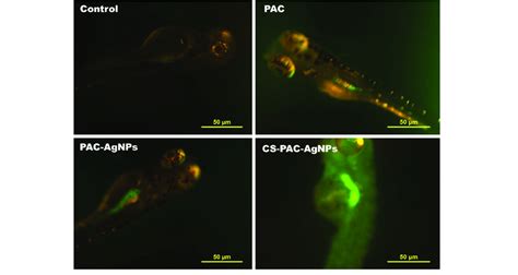 Fluorescent Microscopic Images Of Ros In Zebrafish Larvaes Following