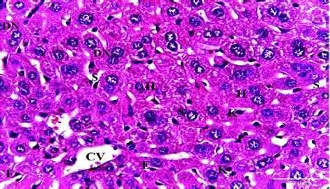 A Photomicrograph Of A Liver Section Of Negative Control Mouse Showing