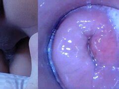 Endoscope Pussy Porn Videos Rexxx