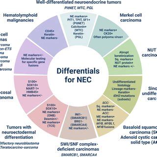 Neuroendocrine carcinoma of the head and neck region. A Sinonasal small... | Download Scientific ...