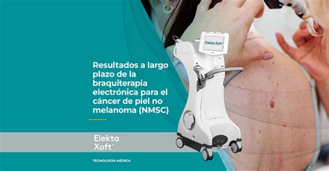 Elekta Xoft Resultados A Largo Plazo C Ncer De Piel Nmsc Atf Sica