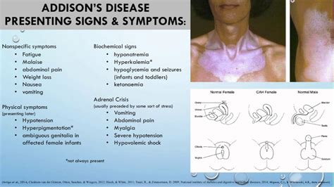 Addisons And Cushing Syndrome In Children Youtube