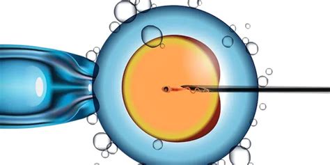 Advancements In IVF Treatment New Techniques For Success Apollo