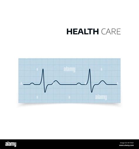 Diagnóstico Médico De Los Latidos Del Corazón Y La Frecuencia Cardíaca Electrocardiograma