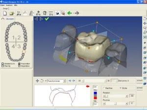 Cad Cam Dentistry – Dental Clinics Turkey