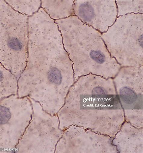 37 Simple Squamous Epithelium Stock Photos High Res Pictures And