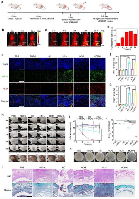 Figure From Potentiating Hypoxic Microenvironment For Antibiotic