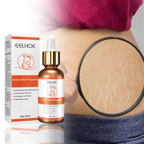 Cengzishu Stretch Mark Repair Essential Oil Scar Cream Stretch Mark