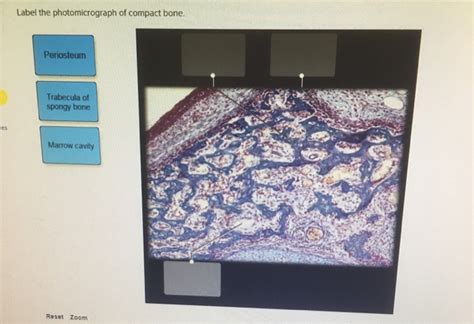 Solved Label The Photomicrograph Of Compact Bone Periosteum Chegg