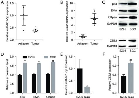 Expression Of Mir P And Zeb In Sgc Tissues And Cells A