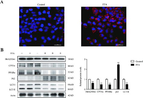 Effect of FFA on HtrA2 Omi expression limiting enzyme of β oxidation