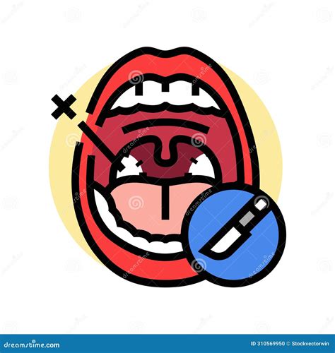 Tonsillectomy Surgery Color Icon Vector Illustration Stock Vector