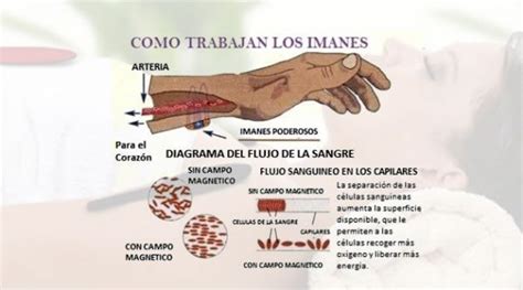 Biomagnetismo Me puede ayudar Clínica de fisioterapia en Madrid