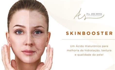 Conhe A O Tratamento Que Hidrata A Pele E Suaviza As Rugas Skinbooster