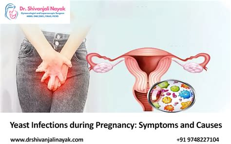 Yeast Infections During Pregnancy Symptoms And Causes