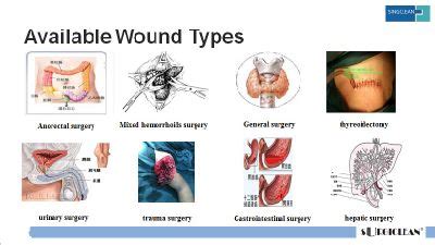 Surgiclean Oxidized Regenerated Absorbable Cellulose Hemostatic Gauze