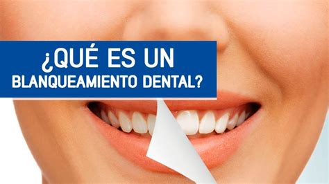 Blanqueamiento Dental Preguntas Frecuentes Odontoespecialistas YouTube