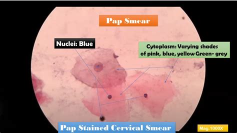 Pap Test Introduction Principle Staining Procedure Result