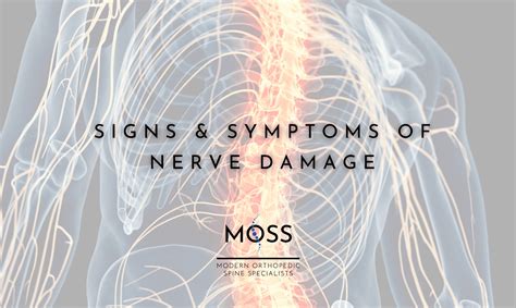 Signs & Symptoms of Nerve Damage - Modern Orthopedic Spine Specialists