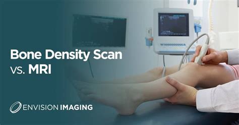 Bone Density Scan vs. MRI - Envision Radiology