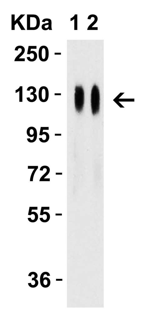 Sars Cov 2 Spike Protein Rbd Polyclonal Antibody Pa5 114529