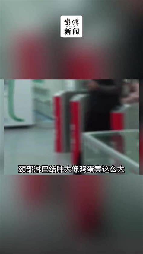 7岁孩子被确诊“亲吻病”，扁桃体发炎高烧一周凤凰网视频凤凰网