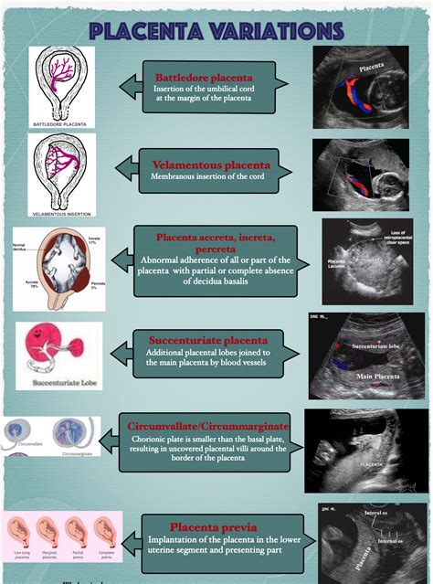 Circummarginate Placenta Ultrasound